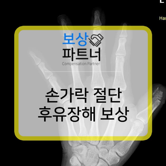 엄지 손가락 절단 생손보험 후유장해 보험금 지급 방법