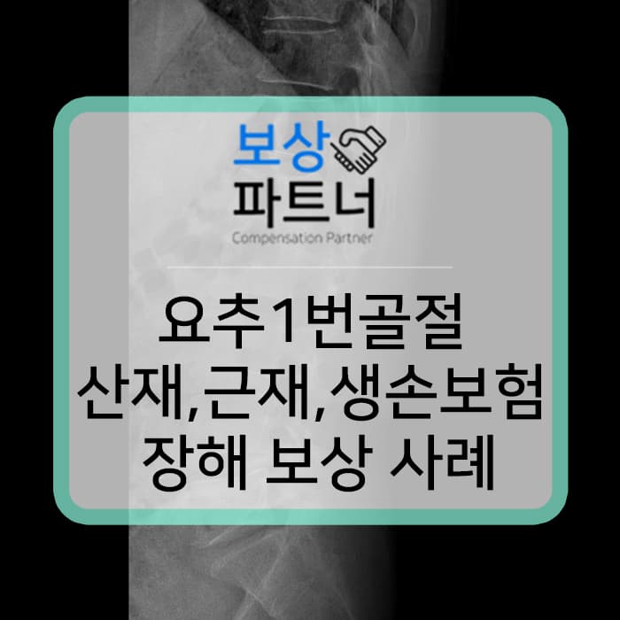 요추압박골절 산재보상금 과 건설업 근재보험 보상 사례