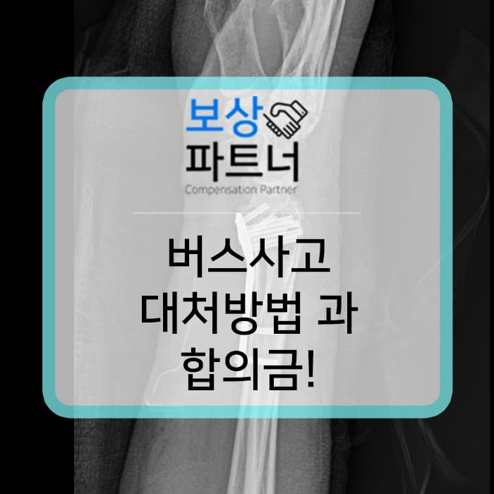 버스사고로 합의금 계산이 궁금하다면? 보상파트너에서 알려드립니다!