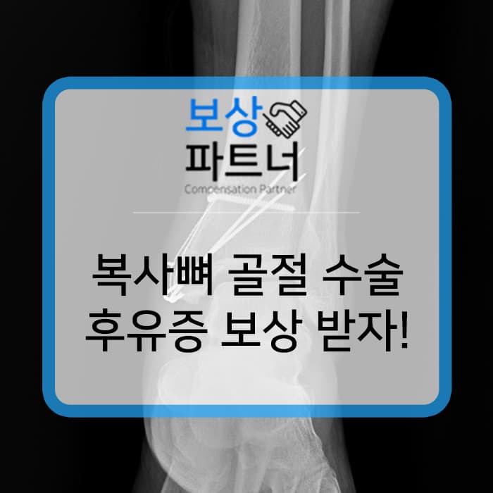 복사뼈 골절 상해 후유장해 3% 보상받은 실제 사례! 보험료 내지만 말고 보험금 받으세요.
