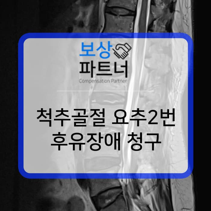 교통사고 시 mri 혹은 ct 검사해야 하는 이유! 요추2번 척추골절 발견해 후유장애보험금 청구함.