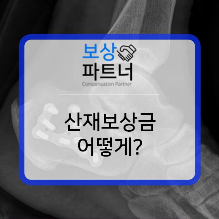 발뒤꿈치골절 산재보상금 장해등급 얼마? 실제 보상사례 살펴보세요!