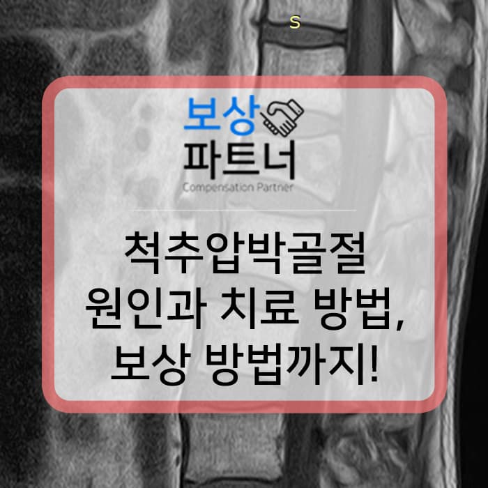 척추압박골절 원인과 치료과정, 보상 방법까지! 후기도 확인해보세요!