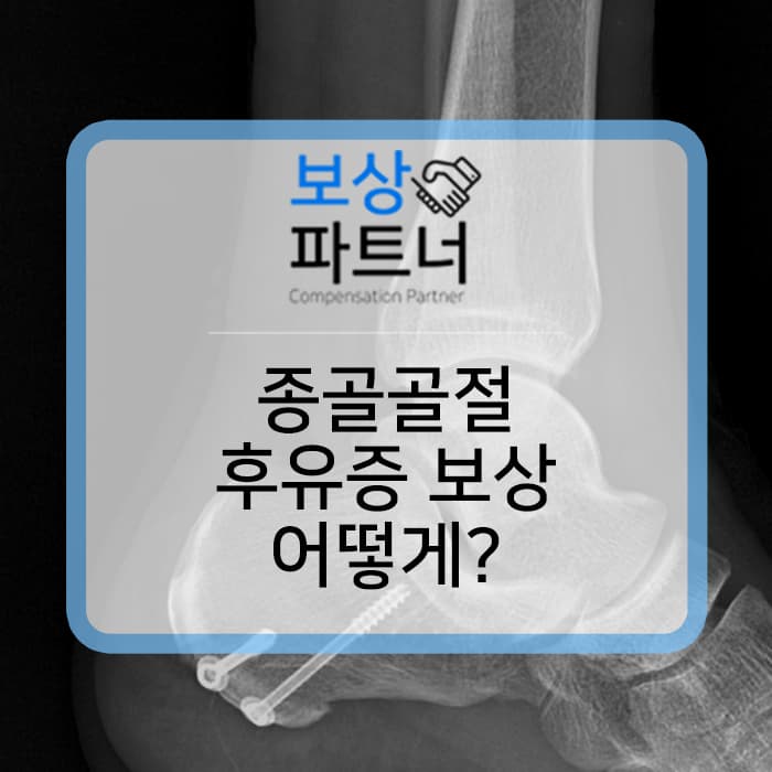 종골골절 (Calcaneus) 후유장해 보험금 나도 받을 수 있을까? 청구 전 필독!