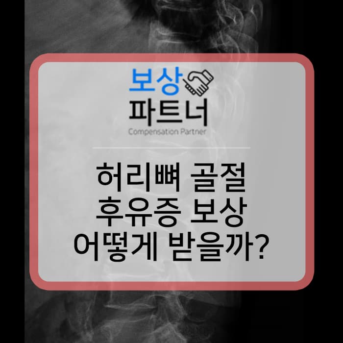 허리뼈골절 후유장애 (후유증) 보상 어떻게 받을 수 있을까요?
