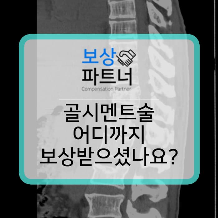 T11 kyphoplasty L2 vertebroplasty 골시멘트술 후유장해 보상까지 받으셨나요?