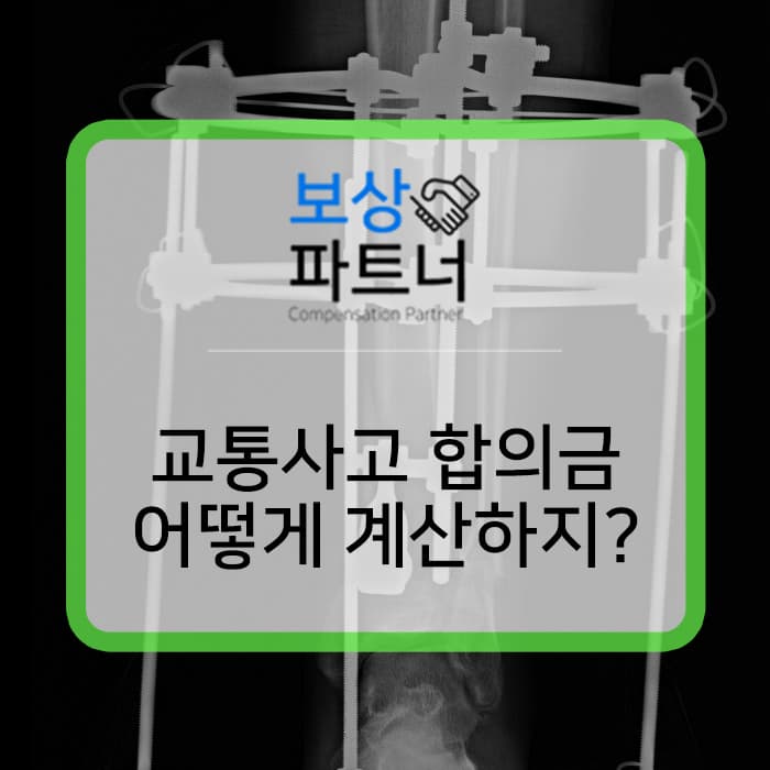 교통사고 합의금 어떻게 산정해야 할까?
