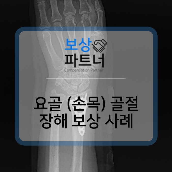 요골골절 보험금 청구 전 후유장해 보상 알아보세요~