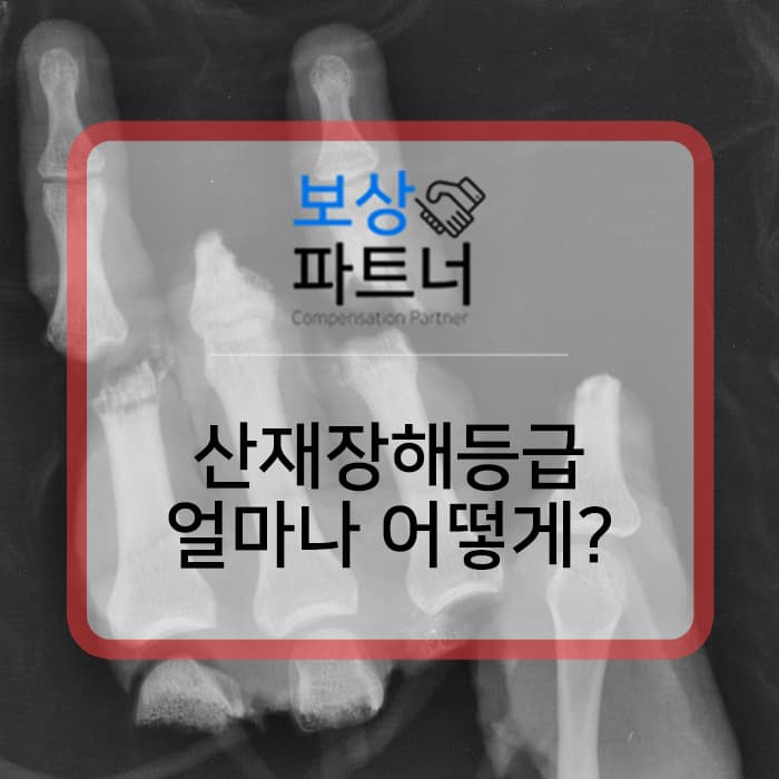 산재장해등급 손가락 접합수술 7급 6호 보상 어떻게 받았을까?