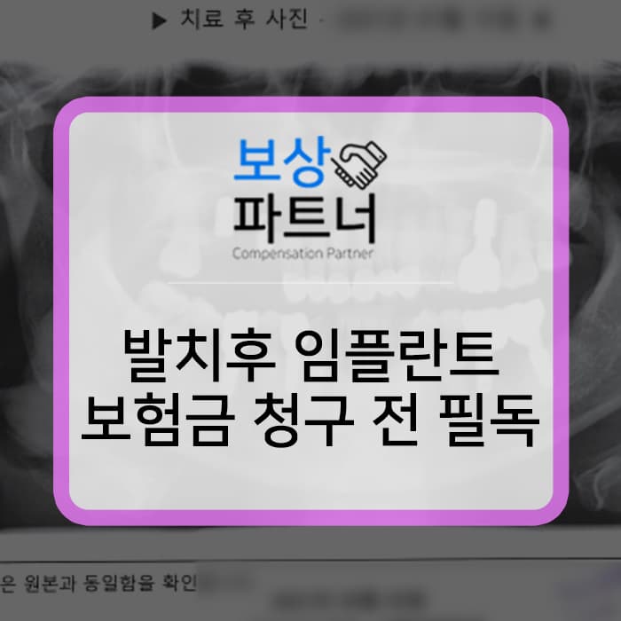 발치후 임플란트 하실 계획인가요? 미리 보험금 청구 알아보세요