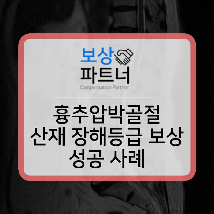 산재 장해등급 척추골절 골시멘트술 받았다면 얼마나?