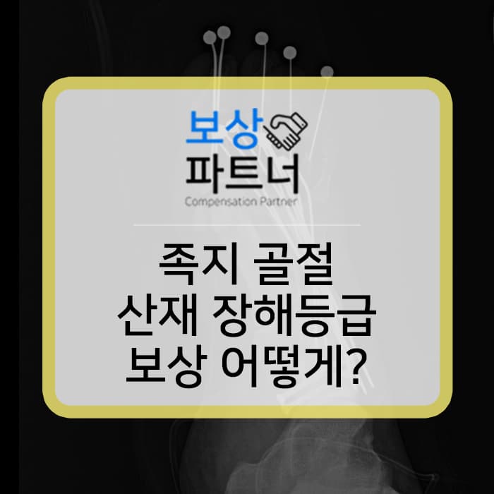산재 장해등급 발가락 골절 수술 얼마나 받았을까?
