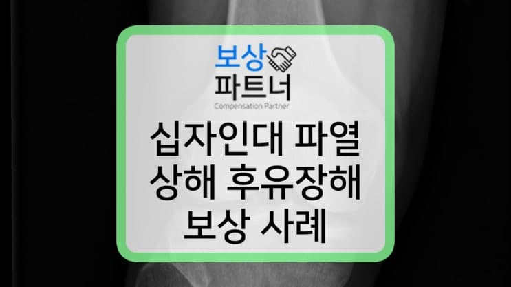 전방십자인대 파열 S8352 후유장해 평가 기준은?