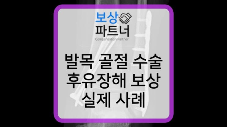 발목 복숭아뼈 골절 수술 상해후유장해 보상 사례