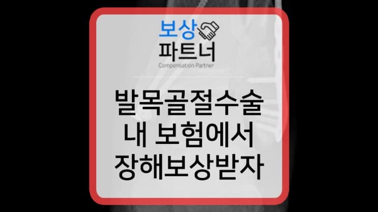 발목골절수술 받아 재활치료 중? 발목 관절 후유장해 보상 알아보세요.