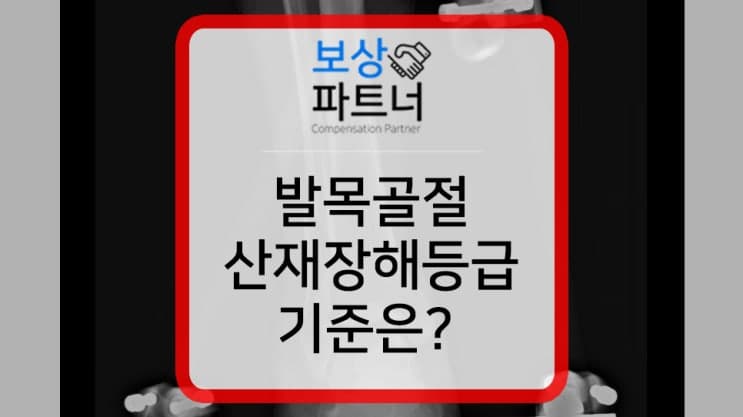 추락사고 다리 비골, 거골 골절 산재처리방법과 산재 장해등급 기준