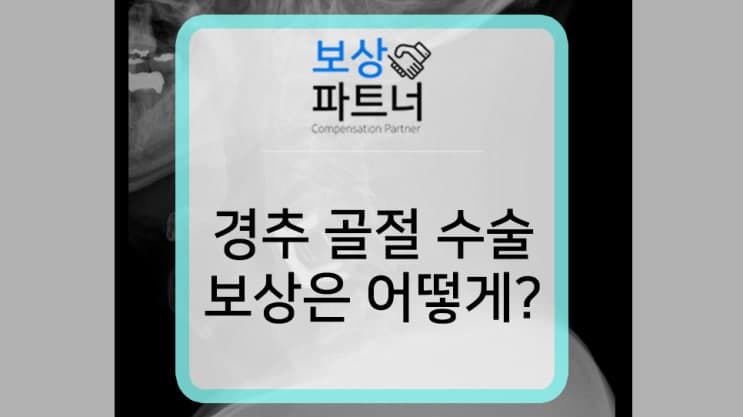 경추 골절 수술, 산재 보상부터 근재보험 보상까지!