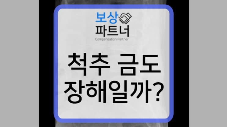 엉덩방아 통증, 알고보니 척추금 ? 요추골절 후유장해 보상 사례