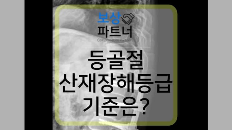 등골절 산재보험 장해등급표 비수술 보존치료와 수술한 경우 어떻게 다를까?