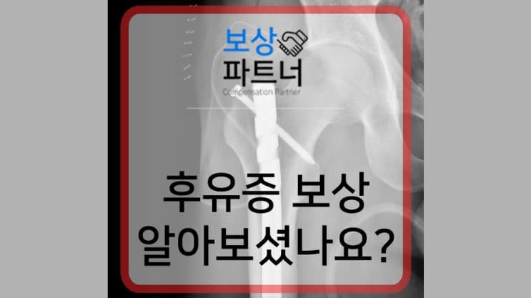 의료용 워커 / 사고로 인해 허리, 고관절, 인공관절 치환술 등의 이유라면 상해 후유장해 보상도 알아보세요.