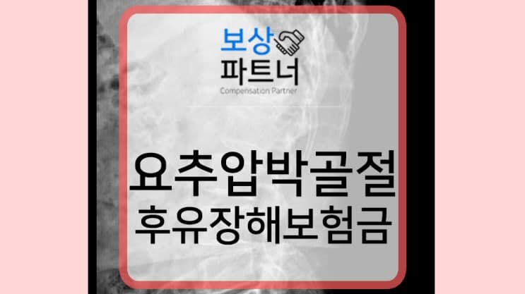 요추압박골절 1번척추 허리뼈골절 비수술 30% 4급 장해 보상 사례