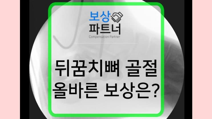 뒤꿈치뼈 발 골절 수술, 보험금 청구 중 정말 중요한 것은?