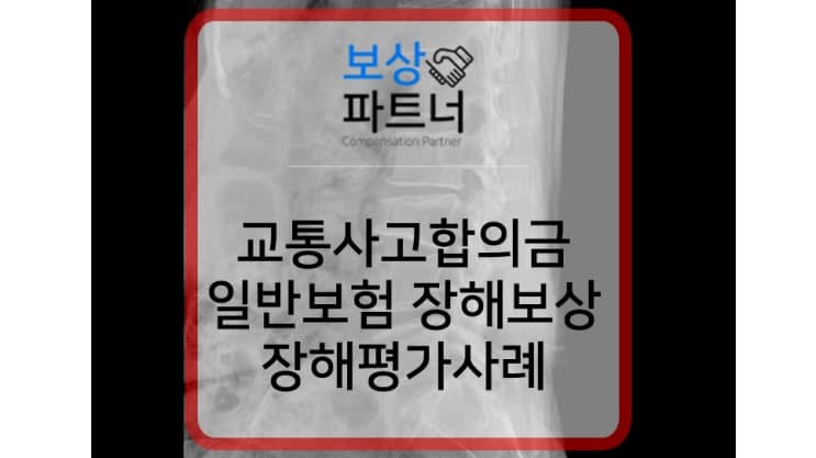 척추압박골절 교통사고 합의금과 장해 보험금 보상 성공 사례