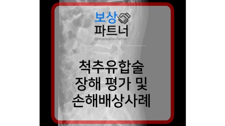 척추유합술 고정수술 후유장해 평가 및 손해배상 1억원 보상사례