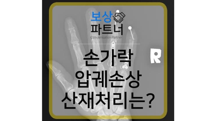 손가락 압궤손상 산재 장해등급 11급 보상 사례