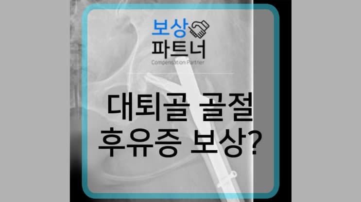femur neck 대퇴골 경부 골절 1,100만 원 장해 보상 사례
