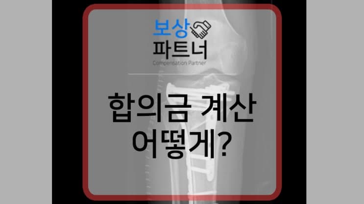 무릎, 발목골절수술 – 교통사고 합의금 계산 사례