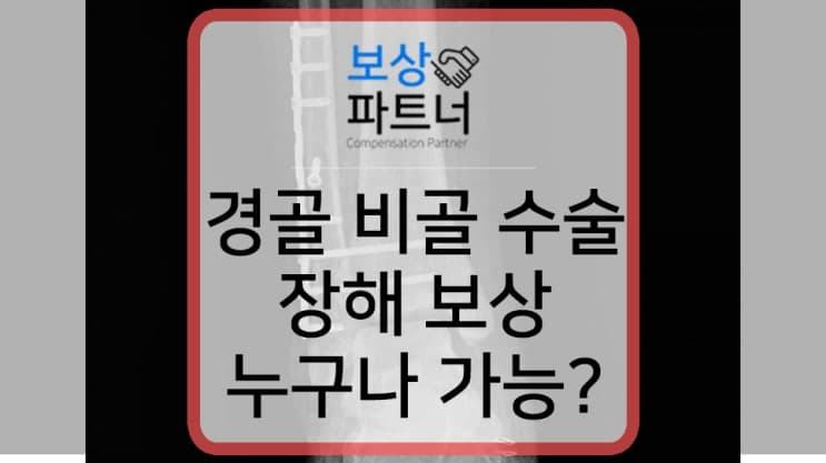 경골 비골 골절 수술, 내 보험에서 1,100만원 보상받다?