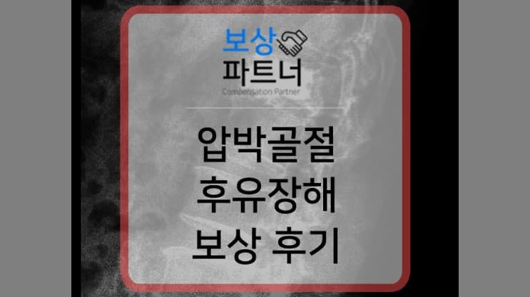 요추1번 흉추12번 압박골절, 혹시 모를 후유증 보상은?