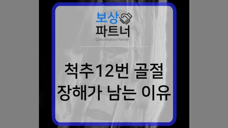 허리압박골절 척추12번 후유장애보험금 2,100만원 보상 후기