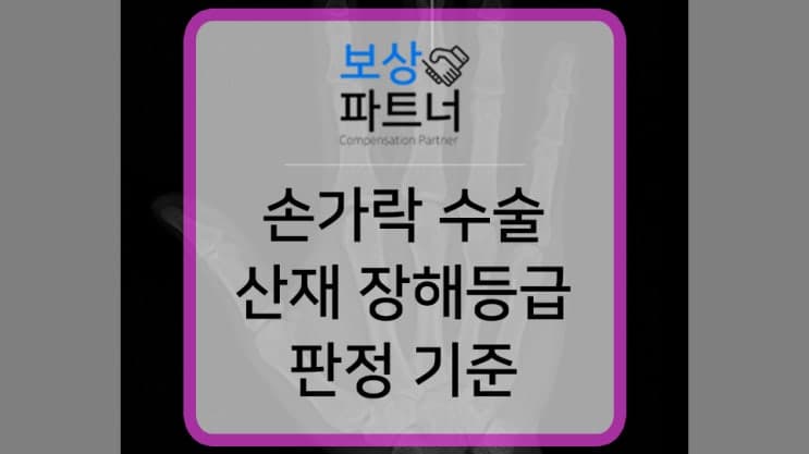 손가락 골절 수술 산재장해등급 판정기준 해설