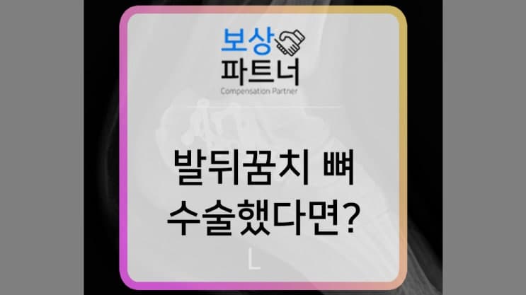 발뒤꿈치 뼈 분쇄골절, 사고 경위에 따른 보상 과정은?
