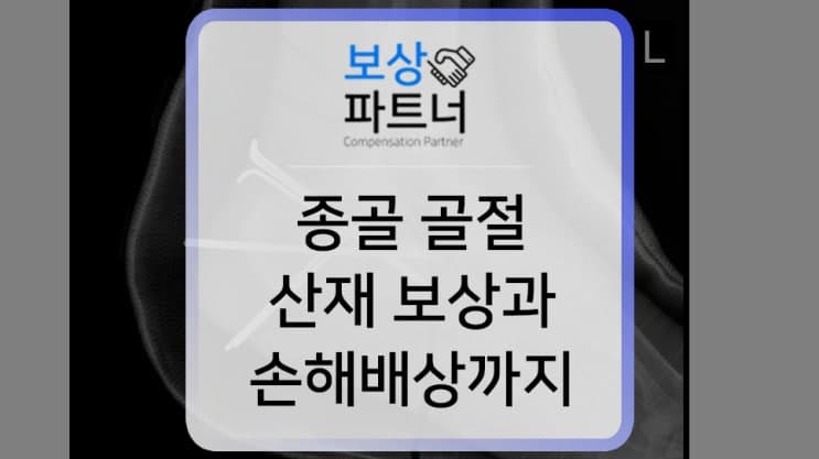 좌측 종골골절 산재 12등급 인정과 고용주에 손해배상금 계산 사례