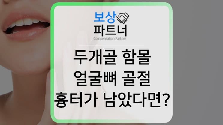 S02 두개골 함몰, 얼굴뼈 골절 / 후유장해보험금 수령한 실제 사례
