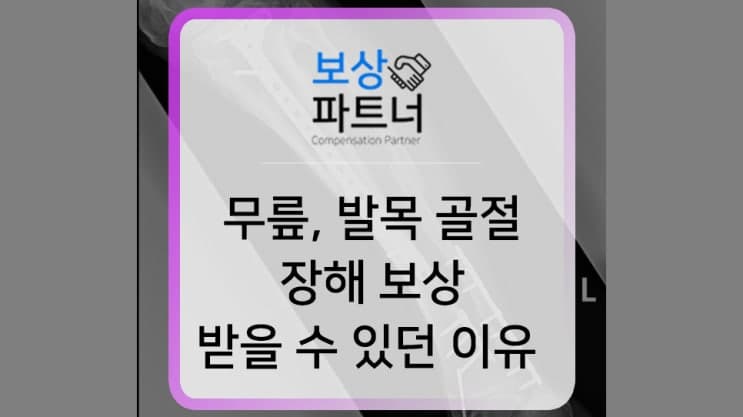 경골 근위부, 경비골 원위부 골절 / 슬관절과 족관절 후유장해 보상 사례