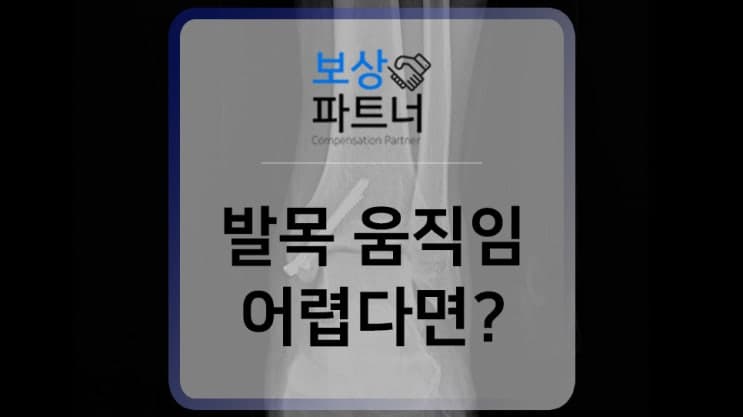 복사뼈 골절 수술, 검토해봐야 하는 후유장해보험금 기준 및 평가