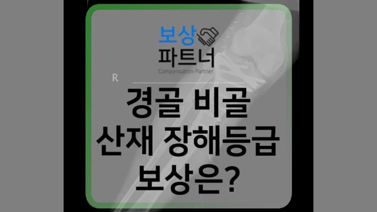 경골 정강이뼈 골절 수술, 산재 장해등급 보상은 어떻게?