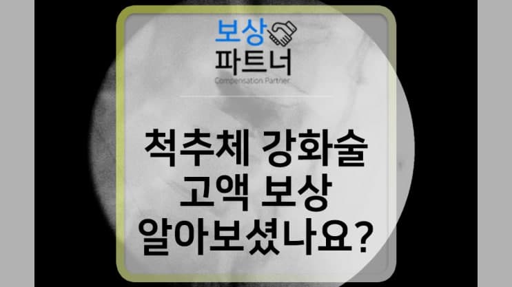 경피적 척추체 강화술, 아는 사람만 청구하는 고액 보상금 있습니다.