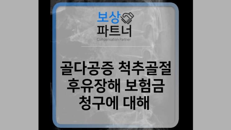 골다공증 척추골절, 내 보험 후유장해 보험금 알아봐야 하는 이유