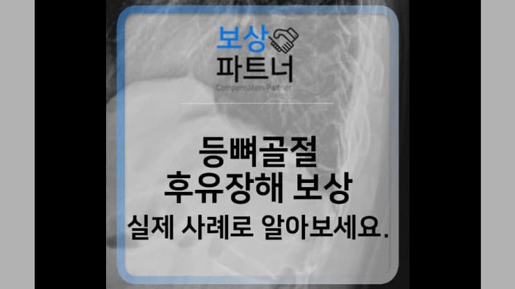 등뼈 골절, 후유장해 보험금 손해사정 도움받은 후기