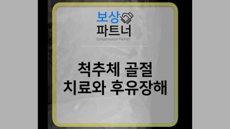 추체 압박골절, 척추골 골절 치료와 후유장해 보상