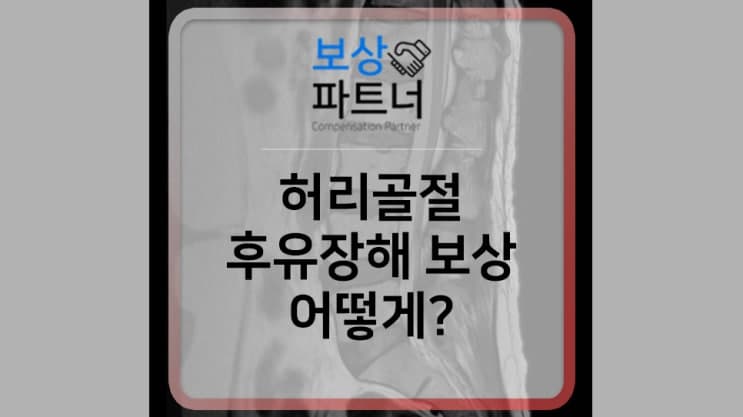 허리 압박 골절 증상과 치료, 후유장해 보험금 보상 어떻게?