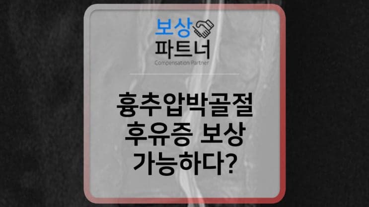 흉추압박골절 후유증 보상? 후유장해 보험금 보상 사례 후기
