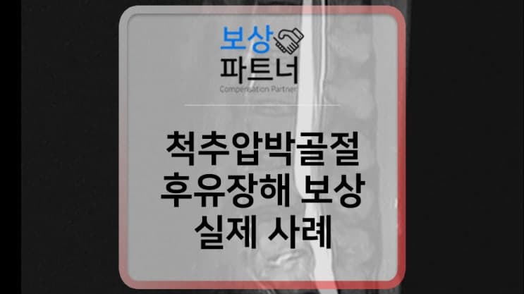 척추압박골절 허리보조기 착용했는데 후유장해 보험금 보상 가능하다? 실제 사례