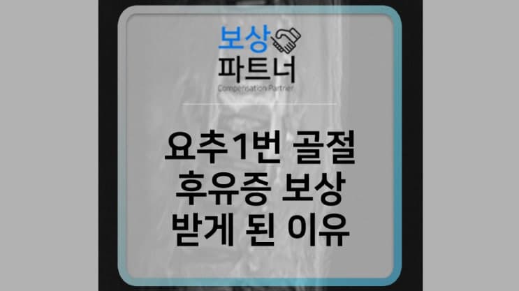 요추1번 압박골절 비수술. 후유장해 보험금 후유증 보상 받을 수 있었던 이유