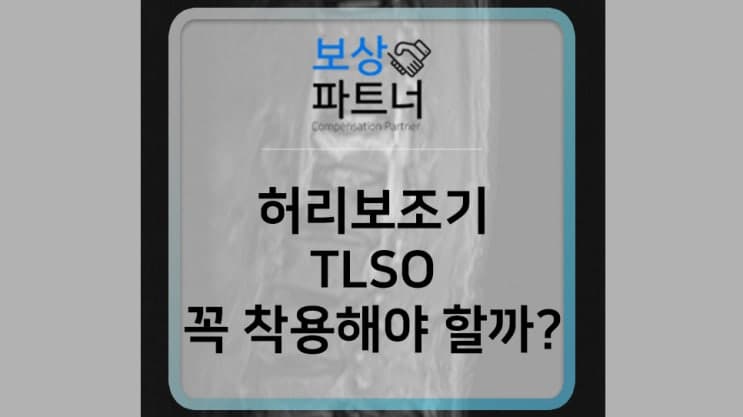 TLSO(허리보조기) 꼭 착용해야 할까?